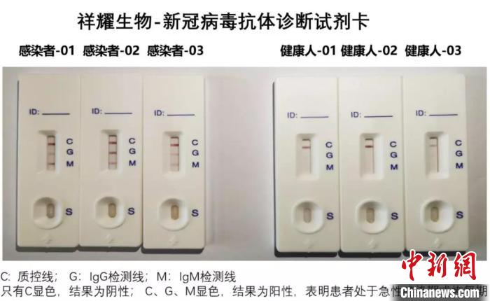 新型冠状病毒快速诊断试剂盒，交付浙江大学医学院附属第一医院，开展临床验证。　华东师大供图 摄