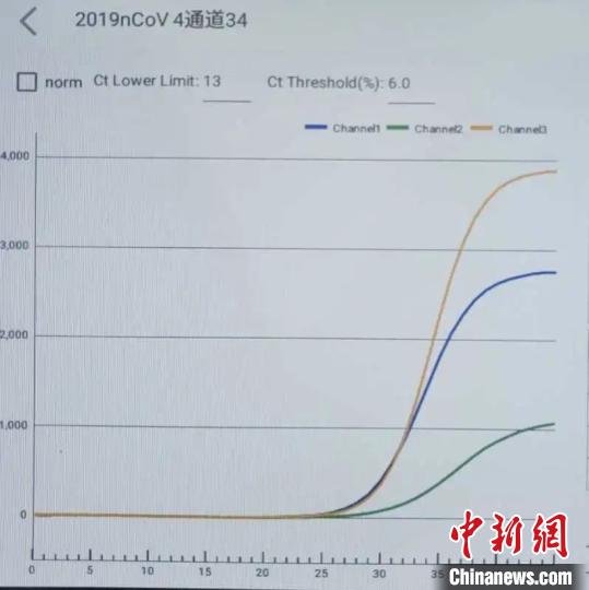 免提取一步法核酸荧光PCR检测结果(30 分钟左右检出)。　杭州医学院提供 摄