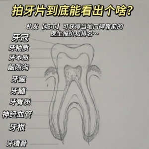 牙齿xray怎么看神经？